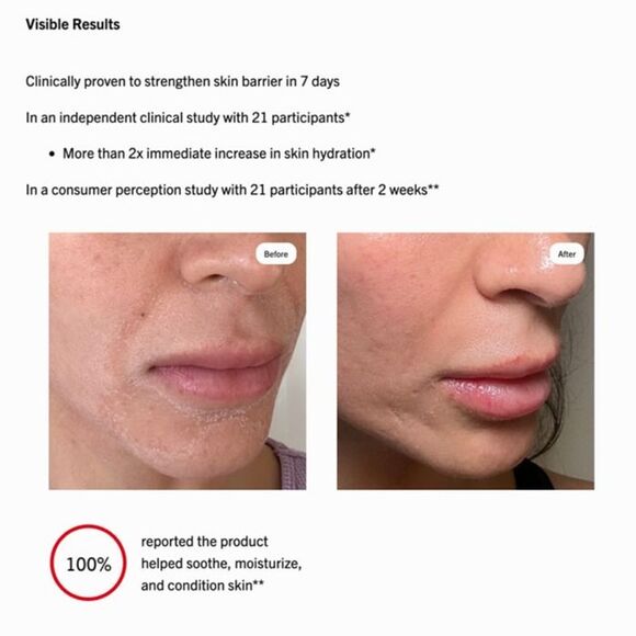 NEW First Aid Beauty Ultra Repair Cream Intense Hydration Face Body Moisturizer - Picture 4 of 12